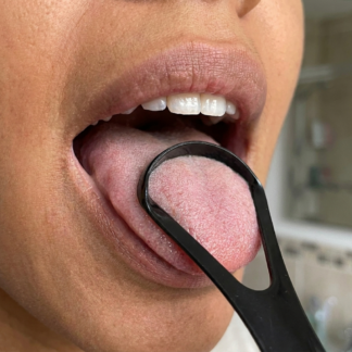 Tongue Scraper